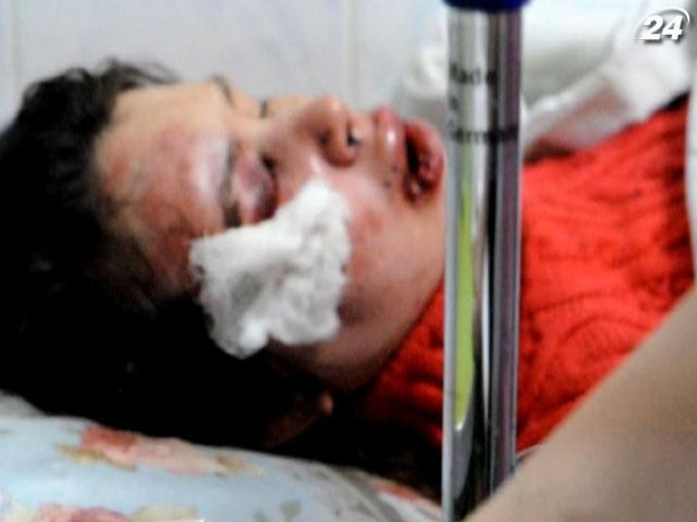 У США розкритикували дії влади за побиття Чорновол У США розкритикували дії влади за побиття Чорновол