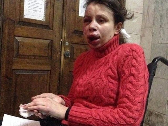 Стало известно имя и фамилия одного из нападавших на Черновол Стало известно имя и фамилия одного из нападавших на Черновол