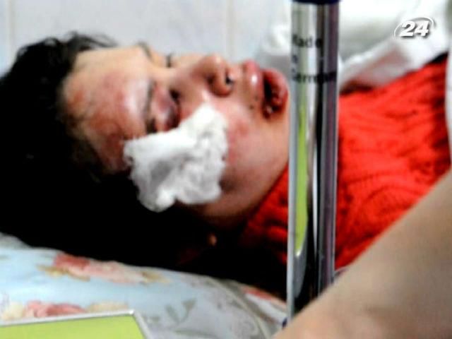 США вимагає негайного прозорого розслідування побиття Чорновол США вимагає негайного прозорого розслідування побиття Чорновол