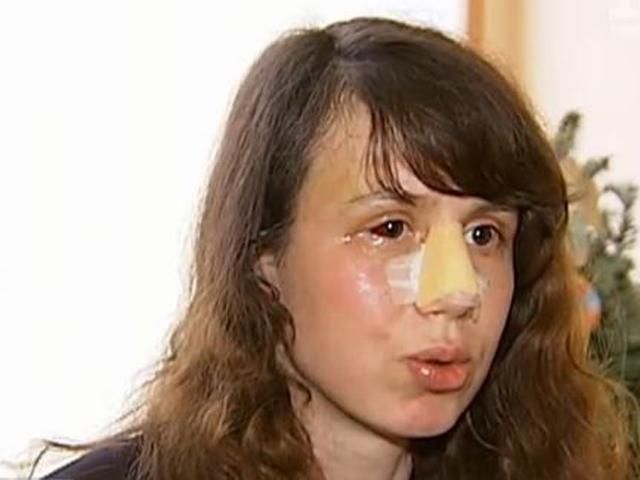 Я стояла з опущеними руками і мене весь цей час били по обличчю, - Чорновол Я стояла з опущеними руками і мене весь цей час били по обличчю, - Чорновол