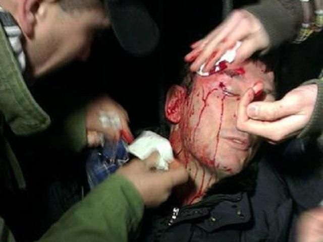 "Беркут" разбил голову Луценко (Фото) "Беркут" разбил голову Луценко (Фото)