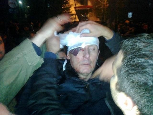 "Беркутовцы" беспощадно били его по голове, мне тоже досталось, - жена Луценко "Беркутовцы" беспощадно били его по голове, мне тоже досталось, - жена Луценко