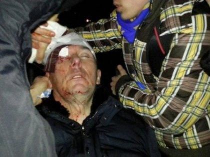 Прокуратура відкрила кримінальне провадження через побиття Луценка Прокуратура відкрила кримінальне провадження через побиття Луценка