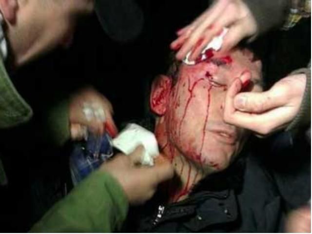 Луценку наклали шви та діагностували струс мозку Луценку наклали шви та діагностували струс мозку