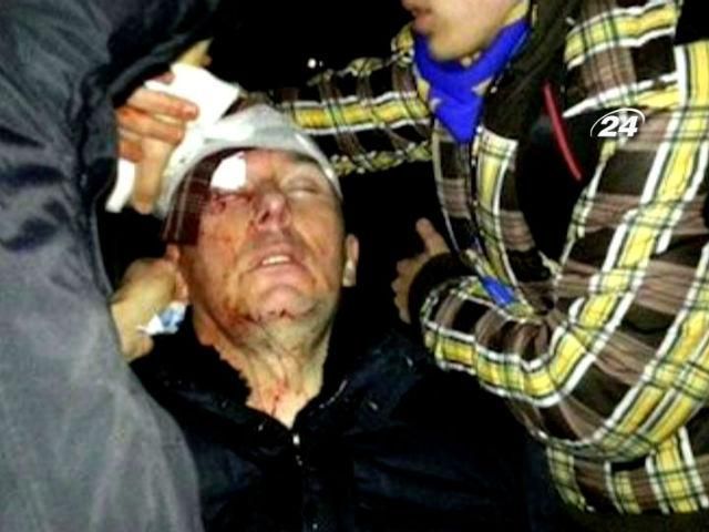 Персона дня: Луценко не судитиметься з "Беркутом" за побиття Персона дня: Луценко не судитиметься з "Беркутом" за побиття