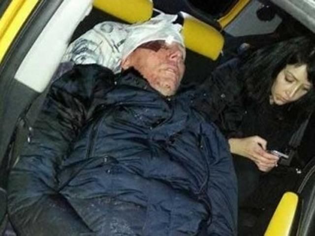 У день побиття Луценко був у стані алкогольного сп'яніння, - головлікар "Соціотерапія" У день побиття Луценко був у стані алкогольного сп'яніння, - головлікар "Соціотерапія"