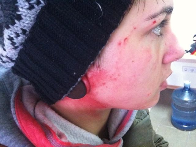 Прихильники регіоналів зірвали акцію Євромайдану у Донецьку, нападали на журналістів (Фото) Прихильники регіоналів зірвали акцію Євромайдану у Донецьку, нападали на журналістів (Фото)