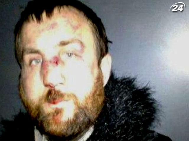 Побитого фотографа зі Львова під конвоєм відправили до лікарні Побитого фотографа зі Львова під конвоєм відправили до лікарні