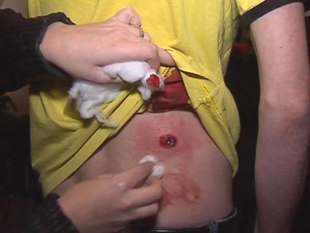 В Запорожье и Днепропетровске пострадали журналисты В Запорожье и Днепропетровске пострадали журналисты