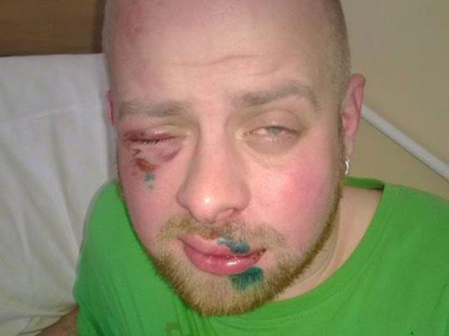 Во Львове избили журналиста, который снимал штурм облсовета Во Львове избили журналиста, который снимал штурм облсовета