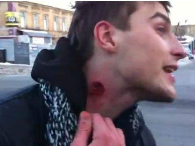 Після зіткнень у Дніпропетровську госпіталізували 5 активістів і 2 міліціонерів Після зіткнень у Дніпропетровську госпіталізували 5 активістів і 2 міліціонерів