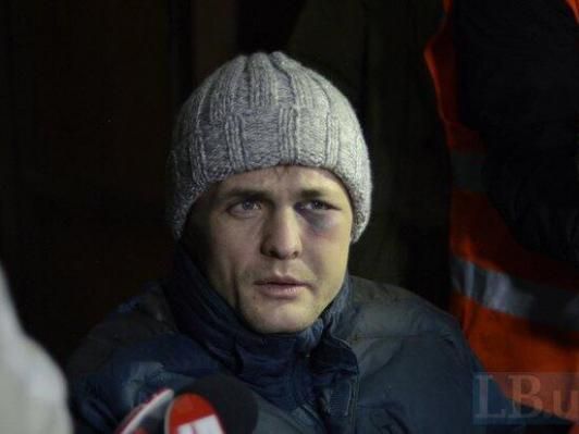 Забій мозку, пошкоджене око, мінус два зуба, — Ігор Луценко Забій мозку, пошкоджене око, мінус два зуба, — Ігор Луценко