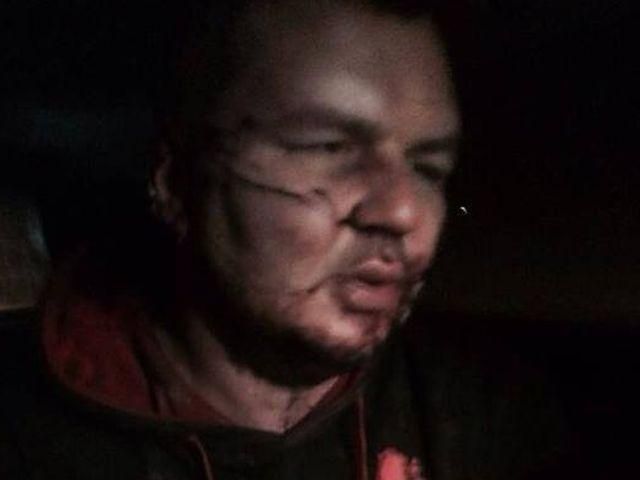 Активиста Булатова пытали, отрезали ему ухо и даже распяли