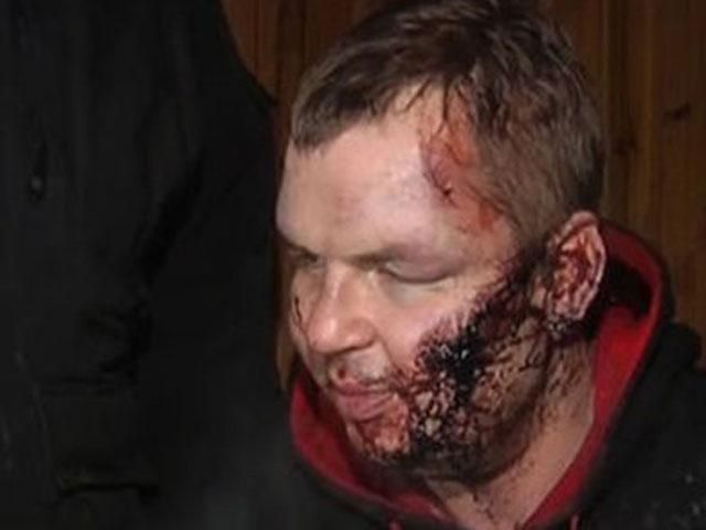 Дмитра Булатова прооперували Дмитра Булатова прооперували