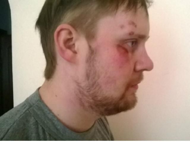 В Киеве похитили и избили российских журналистов (Фото) В Киеве похитили и избили российских журналистов (Фото)