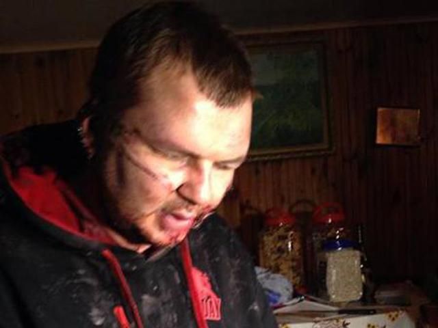 "Справу Булатова" закрито, він відправляється на лікування за кордон, — Порошенко "Справу Булатова" закрито, він відправляється на лікування за кордон, — Порошенко