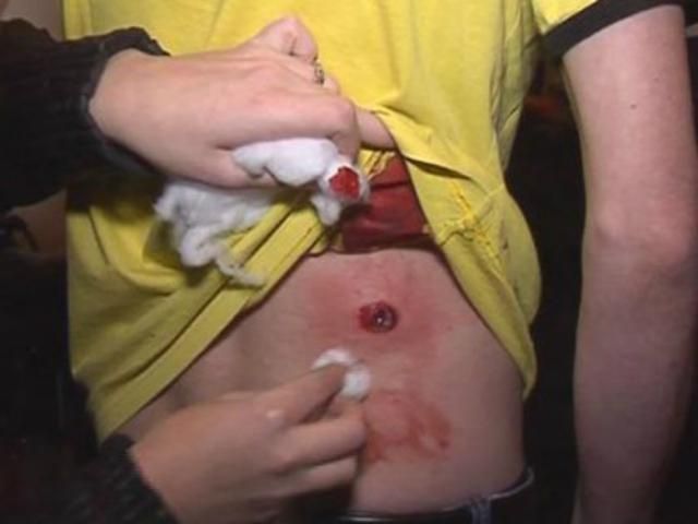 ГПУ не збирається шукати винних у побитті журналістів, — Геращенко ГПУ не збирається шукати винних у побитті журналістів, — Геращенко