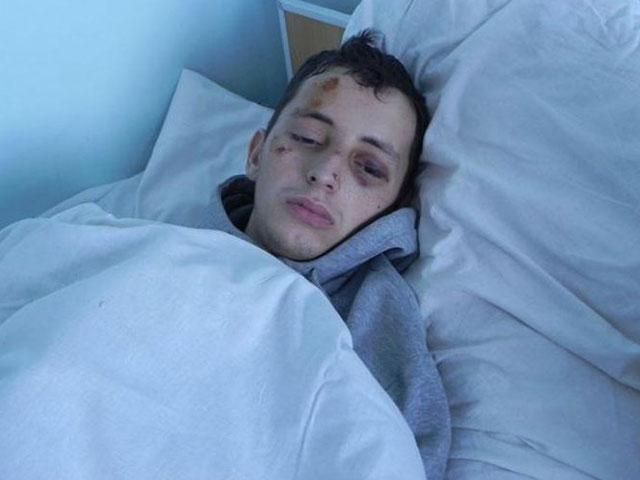 У Дніпропетровську з лікарні зник побитий активіст