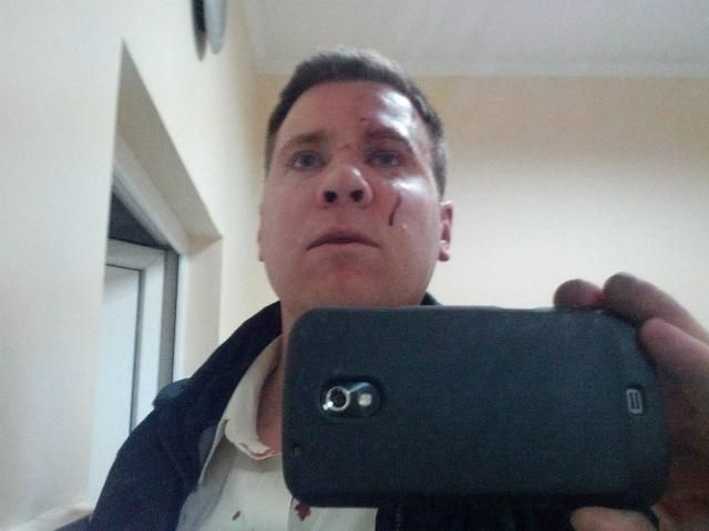 У Сімферополі побили американця, який підтримував Євромайдан (Фото) (Відео) У Сімферополі побили американця, який підтримував Євромайдан (Фото) (Відео)