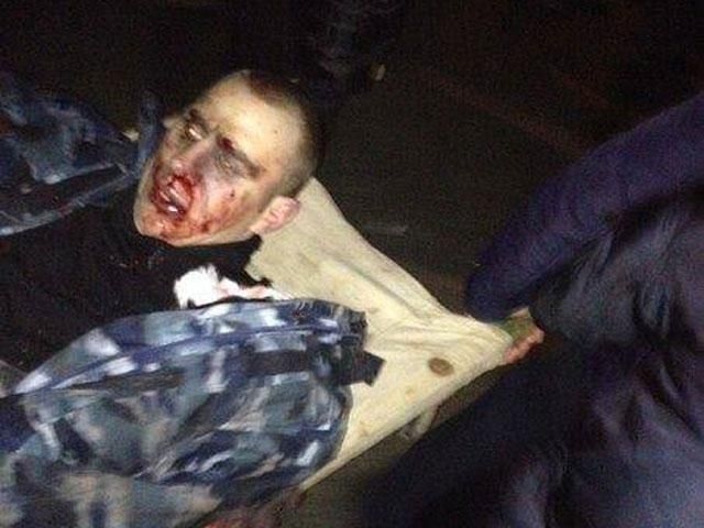 "Беркутовец" подорвался на своей же гранате, — Бригинец "Беркутовец" подорвался на своей же гранате, — Бригинец