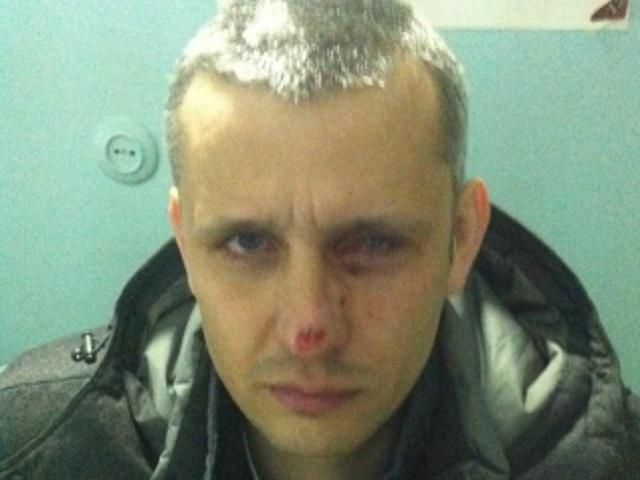 У Києві під час сутичок загинув перший журналіст У Києві під час сутичок загинув перший журналіст