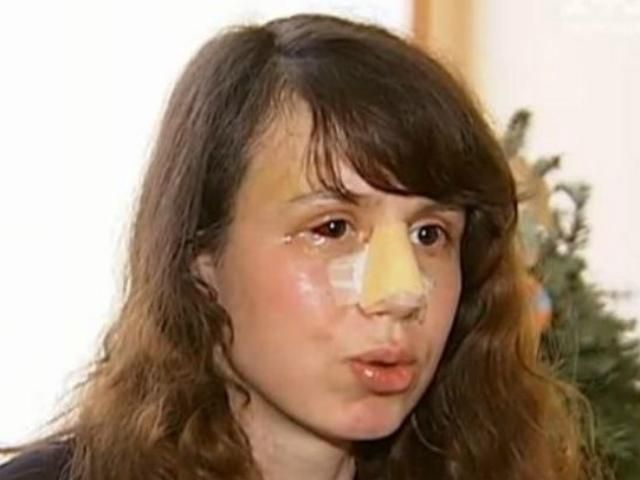 Дело об избиении Черновол переквалифицировали в покушение на убийство Дело об избиении Черновол переквалифицировали в покушение на убийство