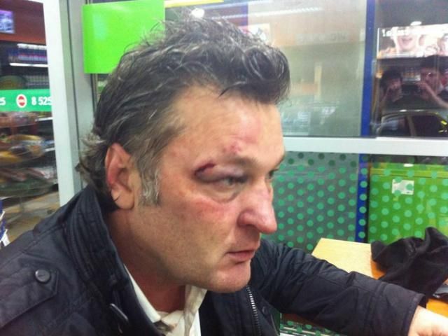 В Крыму похитили и избили телеведущего Геннадия Балашова (Фото) В Крыму похитили и избили телеведущего Геннадия Балашова (Фото)