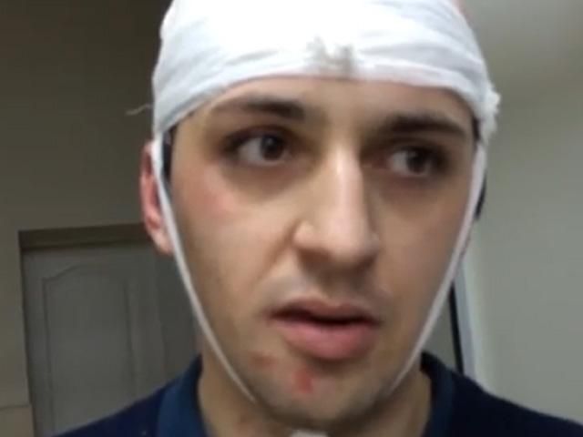 Постраждалий під час сутичок у Донецьку розповів, як нападали сепаратисти (Відео) Постраждалий під час сутичок у Донецьку розповів, як нападали сепаратисти (Відео)