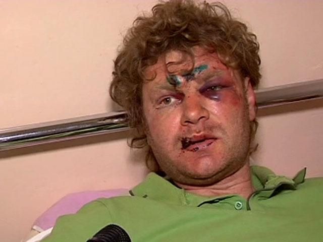 Медики борются за жизнь раненых во время перестрелки в Харькове Медики борются за жизнь раненых во время перестрелки в Харькове