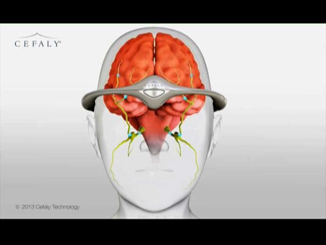 Новинки техники: Дрон-хранитель, виртуальная реальность и диадема от мигрени