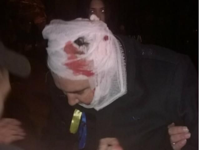 В Николаеве начались столкновения. Есть пострадавшие (Фото) В Николаеве начались столкновения. Есть пострадавшие (Фото)