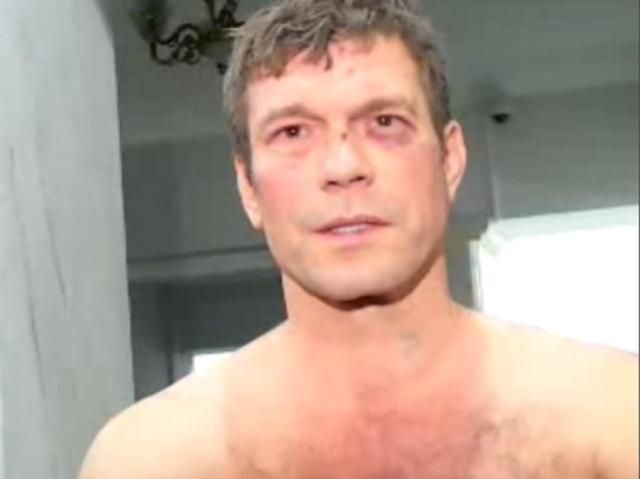 Царев поблагодарил "Правый сектор" за спасенную жизнь Царев поблагодарил "Правый сектор" за спасенную жизнь