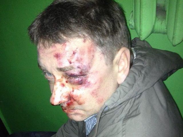 У Сумах біля власного дому побили журналіста У Сумах біля власного дому побили журналіста