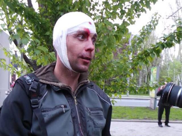 Постраждалий розповів про побоїще у центрі Донецька (Відео)