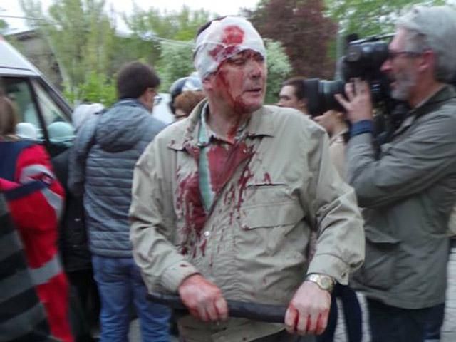 Сепаратисты в Донецке разбили головы около 10 активистам (Фото)