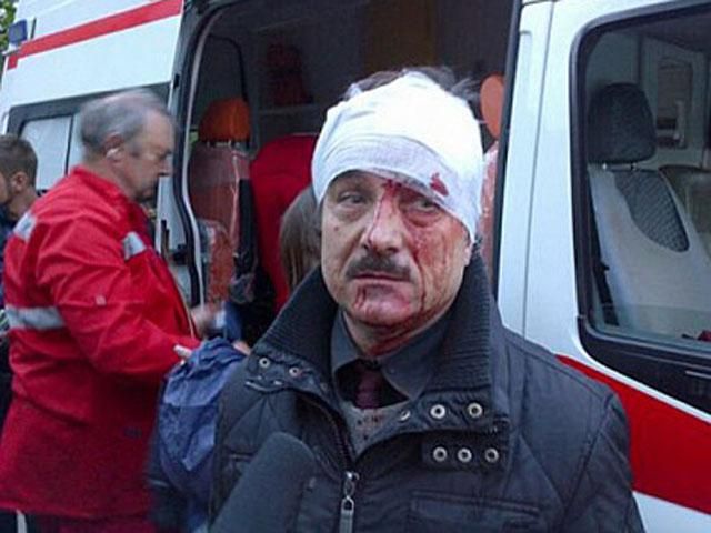 Донецька прокуратура відкрила провадження щодо службової недбалості міліції Донецька прокуратура відкрила провадження щодо службової недбалості міліції