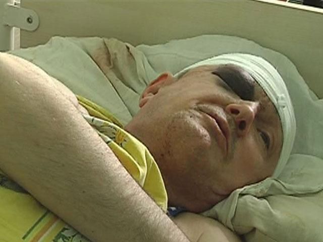 Після донецького побоїща у лікарні залишаються двоє постраждалих Після донецького побоїща у лікарні залишаються двоє постраждалих