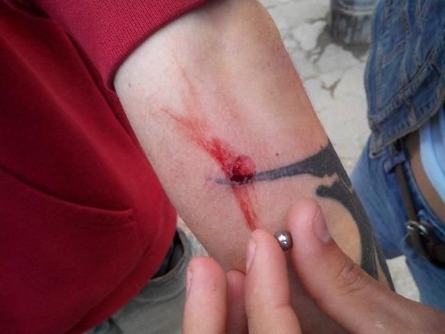 В больницах Одессы - более 160 пострадавших после столкновений, - источник В больницах Одессы - более 160 пострадавших после столкновений, - источник