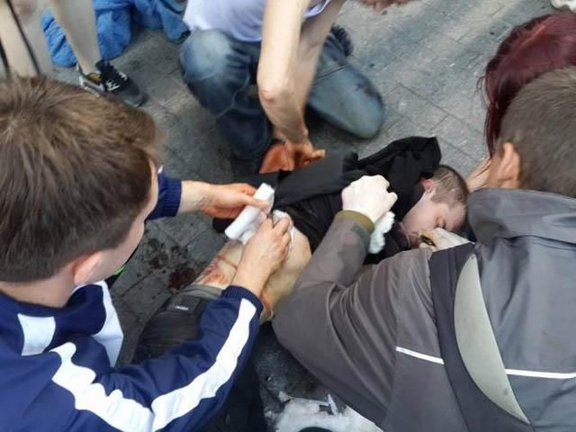 Почти 80 человек остаются в больницах после столкновений 2 мая в Одессе