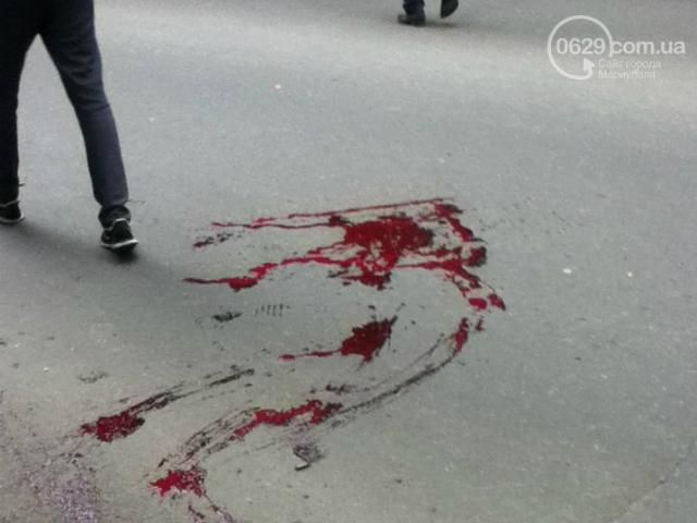 Російського журналіста поранили у Маріуполі (Фото) Російського журналіста поранили у Маріуполі (Фото)