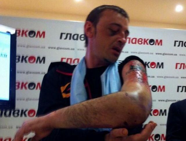 "Донецьку республіку" підтримують приблизно 20% — криміналітет і безробітні, — шахтар "Донецьку республіку" підтримують приблизно 20% — криміналітет і безробітні, — шахтар