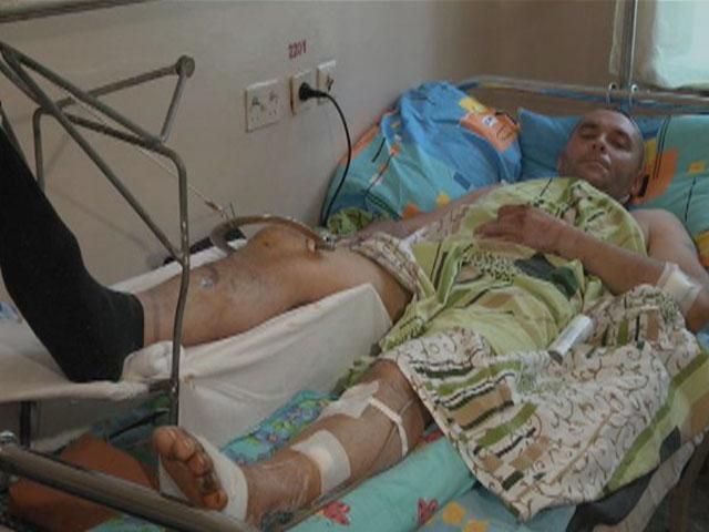 У лікарнях перебувають більше сотні військових, поранених під час АТО У лікарнях перебувають більше сотні військових, поранених під час АТО