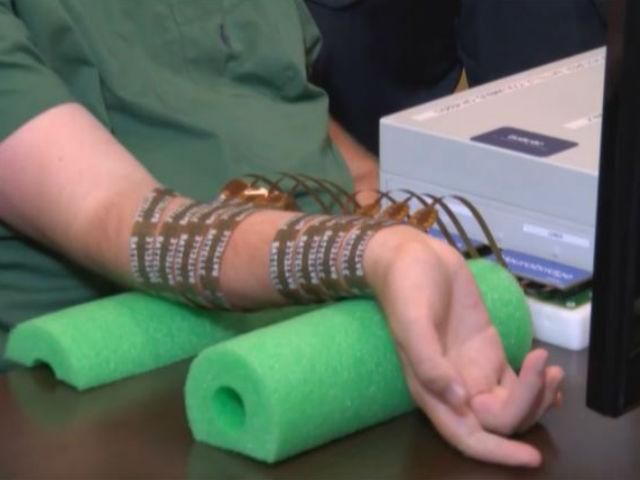 Разработка компании Battelle позволила парализованному пациенту двигать рукой
