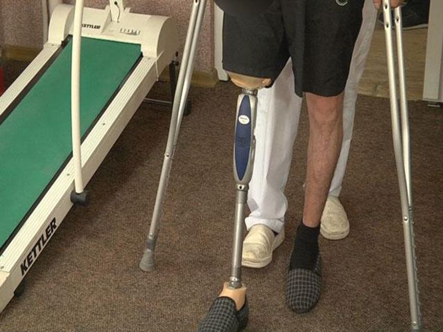 Бионический протез ноги. Ножной протез. Красивые протезы ног. Как получить протез инвалиду. Протезы нижних конечностей.