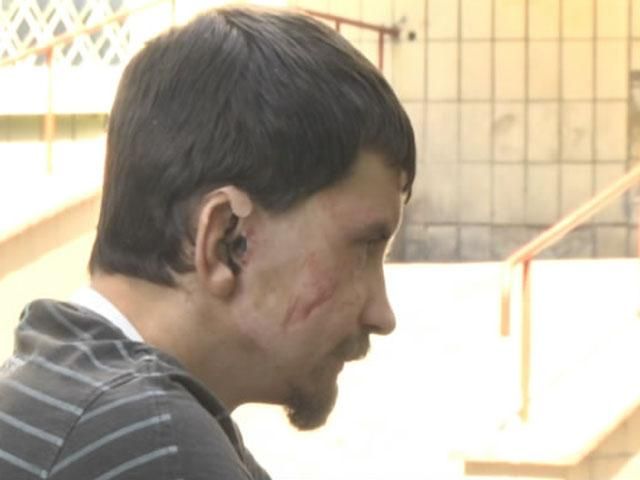 Во время военных действий на Донбассе — ранено более тысячи человек Во время военных действий на Донбассе — ранено более тысячи человек