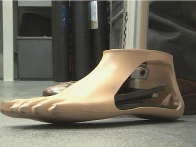 В Черкассах бесплатно изготавливают протезы для участников АТО В Черкассах бесплатно изготавливают протезы для участников АТО