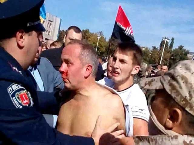 Аваков особисто проконтролює розслідування побиття Шуфрича Аваков особисто проконтролює розслідування побиття Шуфрича