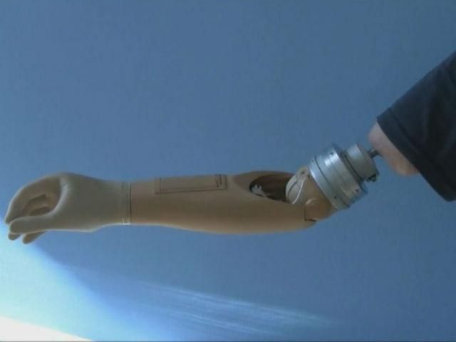 В Швеции ученые изготовили роботизированную руку
