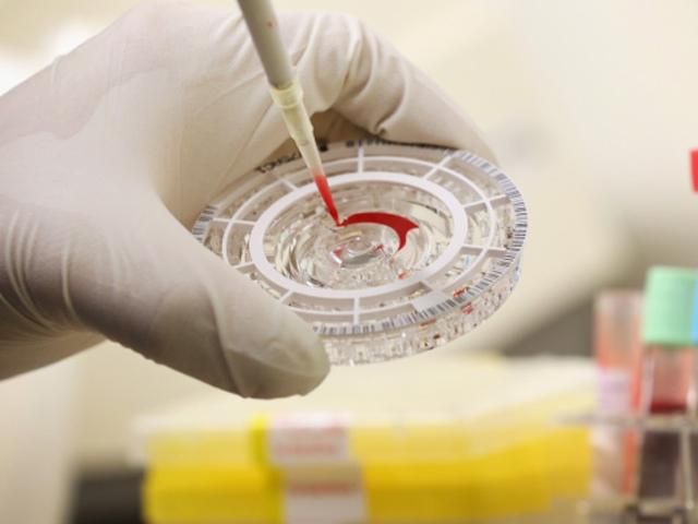 В США разработали два новых способа обнаружения Эболы В США разработали два новых способа обнаружения Эболы