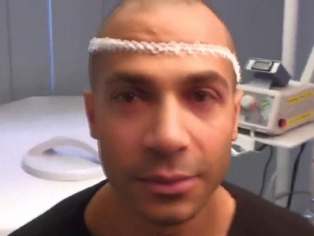 Факты о здоровье. Ученые исследовали причины мужского облысения Факты о здоровье. Ученые исследовали причины мужского облысения